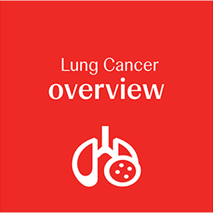 Thumbnail image for Lung cancer overview chapter